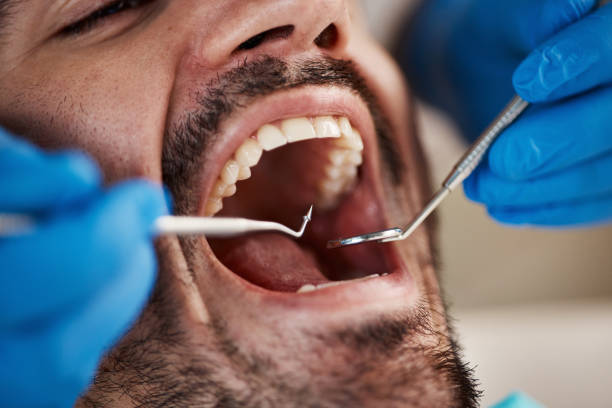 Best Emergency Dental Filling Replacement  in High Point, FL