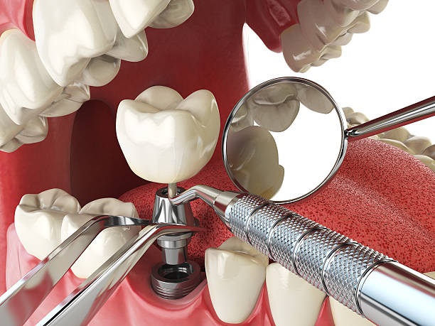 Best Emergency Tooth Extraction  in High Point, FL